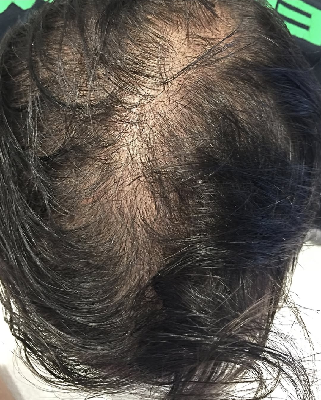 Prima F-HAIR MEN